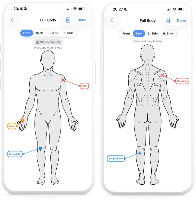 The GreenNotes full-body map on two phones, front and back views, with pain, burn, instability, swelling and surgical-site markers placed on the figures